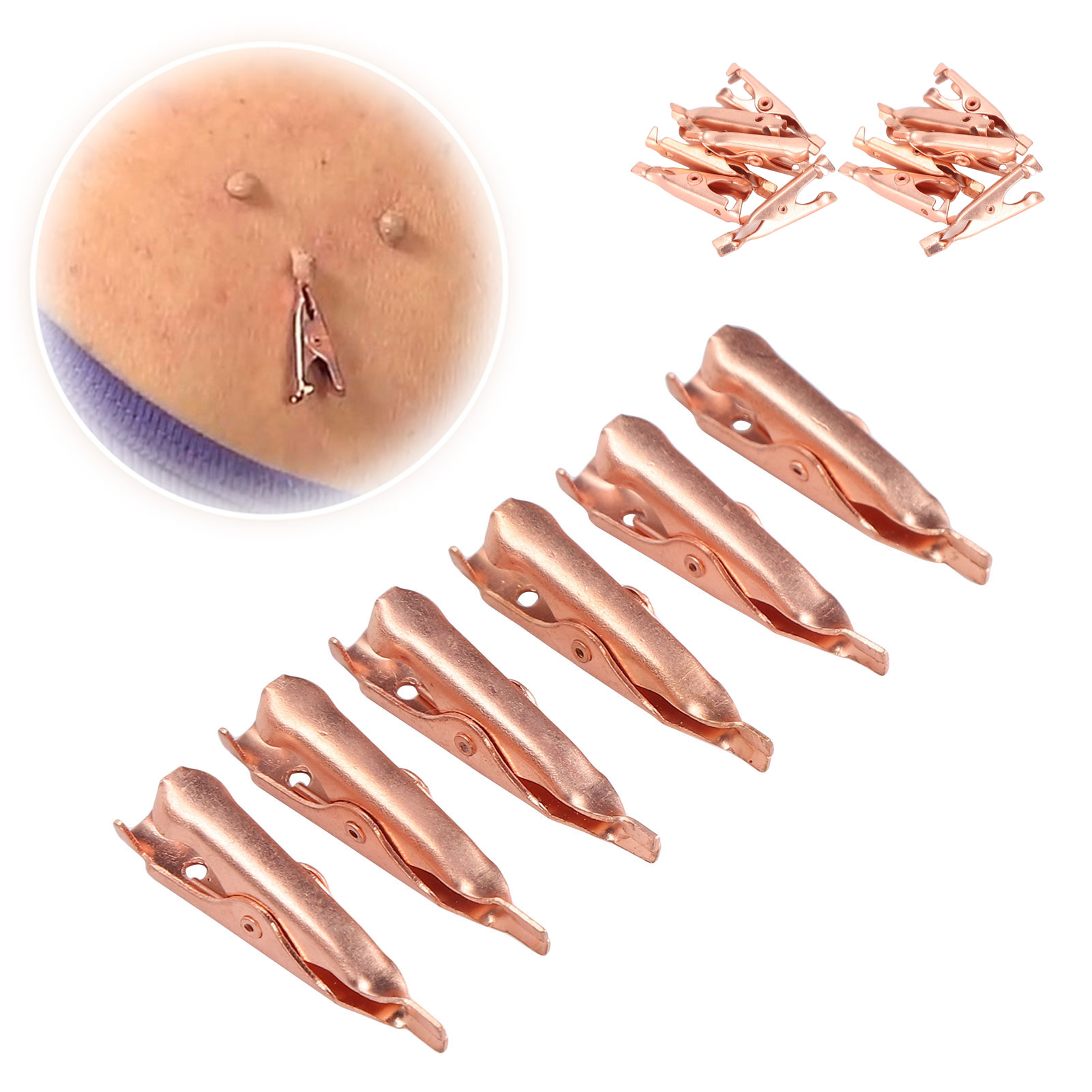 Skin Tag Remover Clips Safe Copper Smooth Skin Tag Removal Tool For Face L2S - Picture 29 of 29