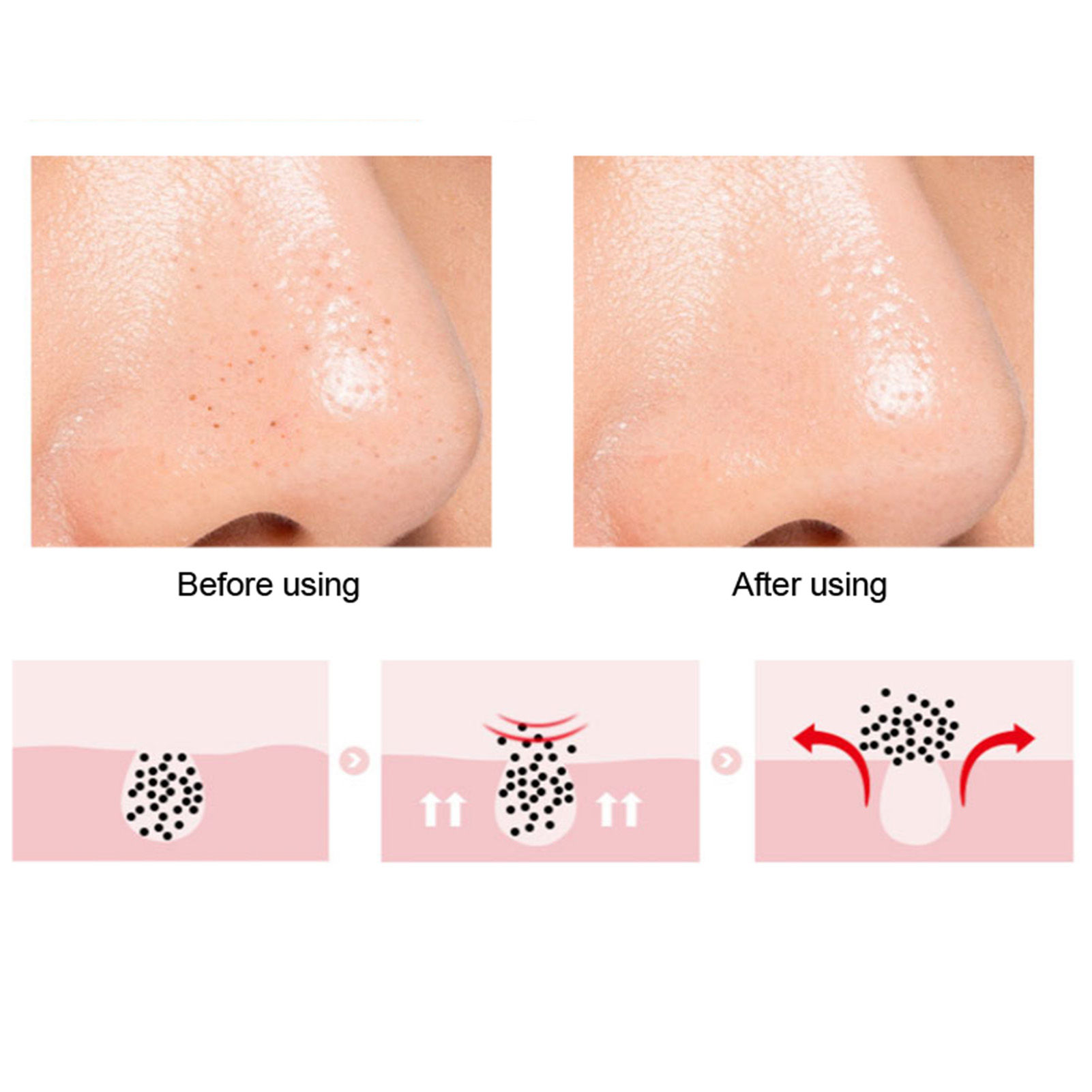 Soft Silicone Nose Cleansing Brush Deep Cleaning Double Sided Exfoliating Li HPT - Picture 29 of 45