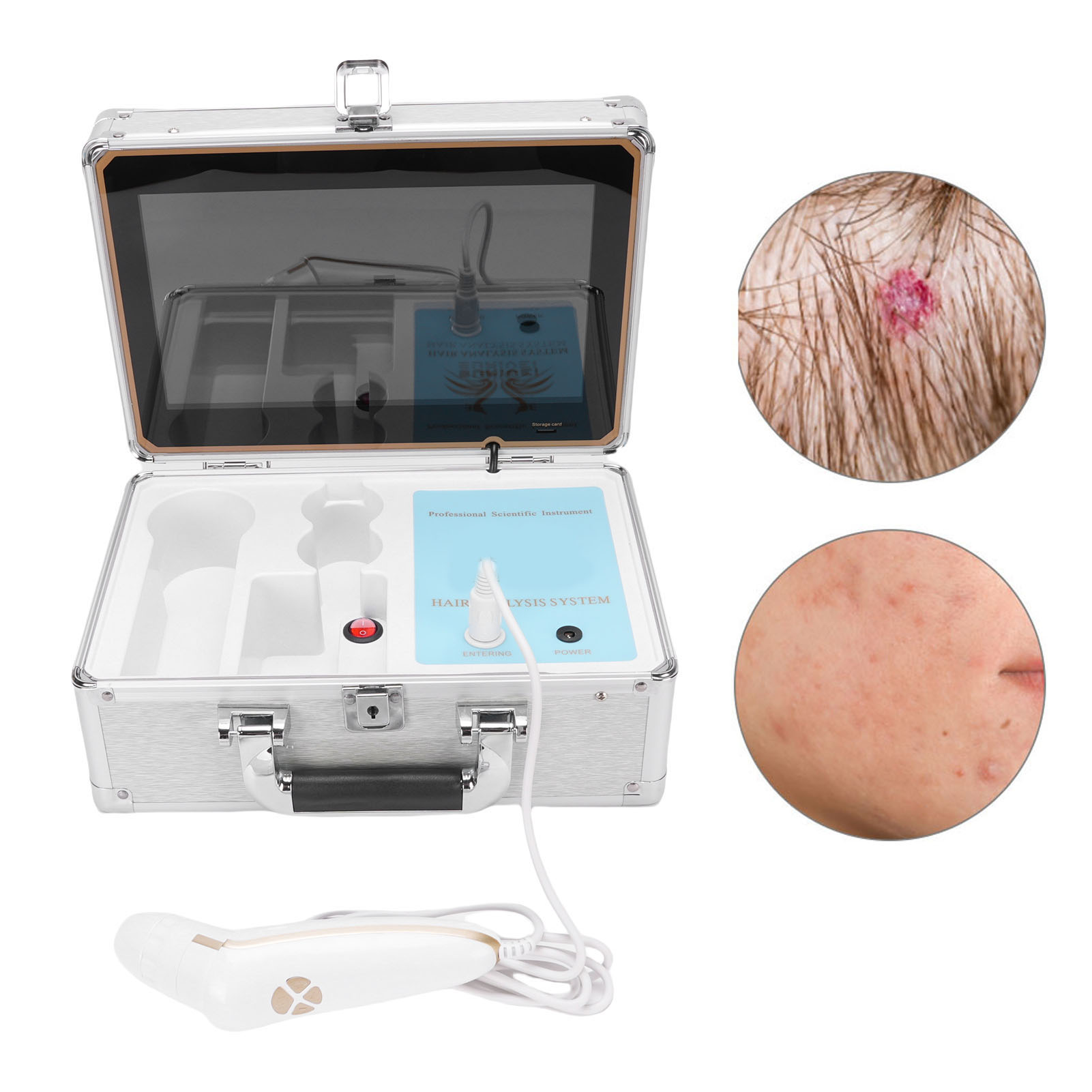 12 Inch Skin Scalp Detector with Remote Control Rechargeable 50X 200X Scalp Test - Picture 15 of 21