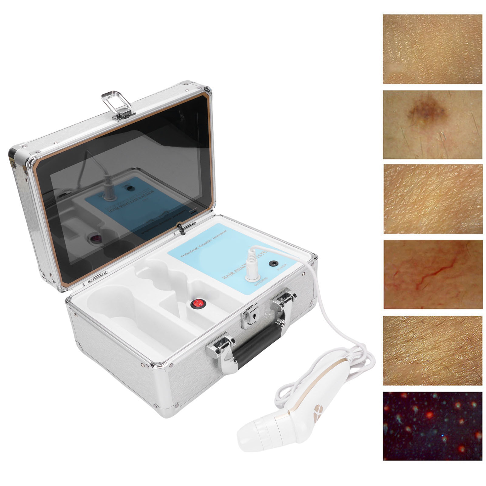 12 Inch Skin Scalp Detector with Remote Control Rechargeable 50X 200X Scalp Test - Picture 16 of 21